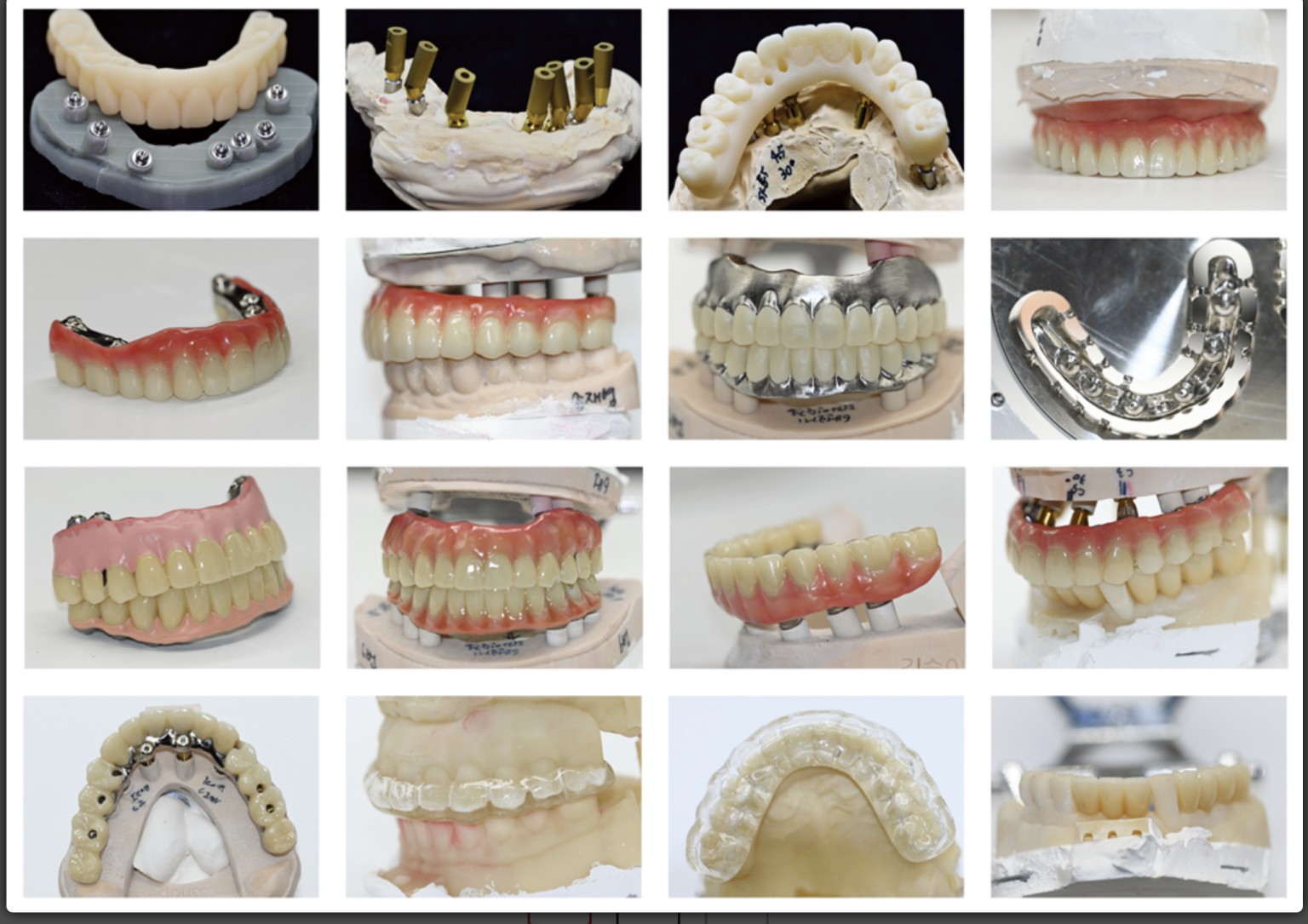 Mouthguard Color Chart – JN Dental Lab